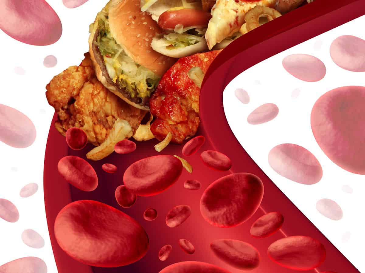 Cholesterol:friend or foe from a functional medicine perspective