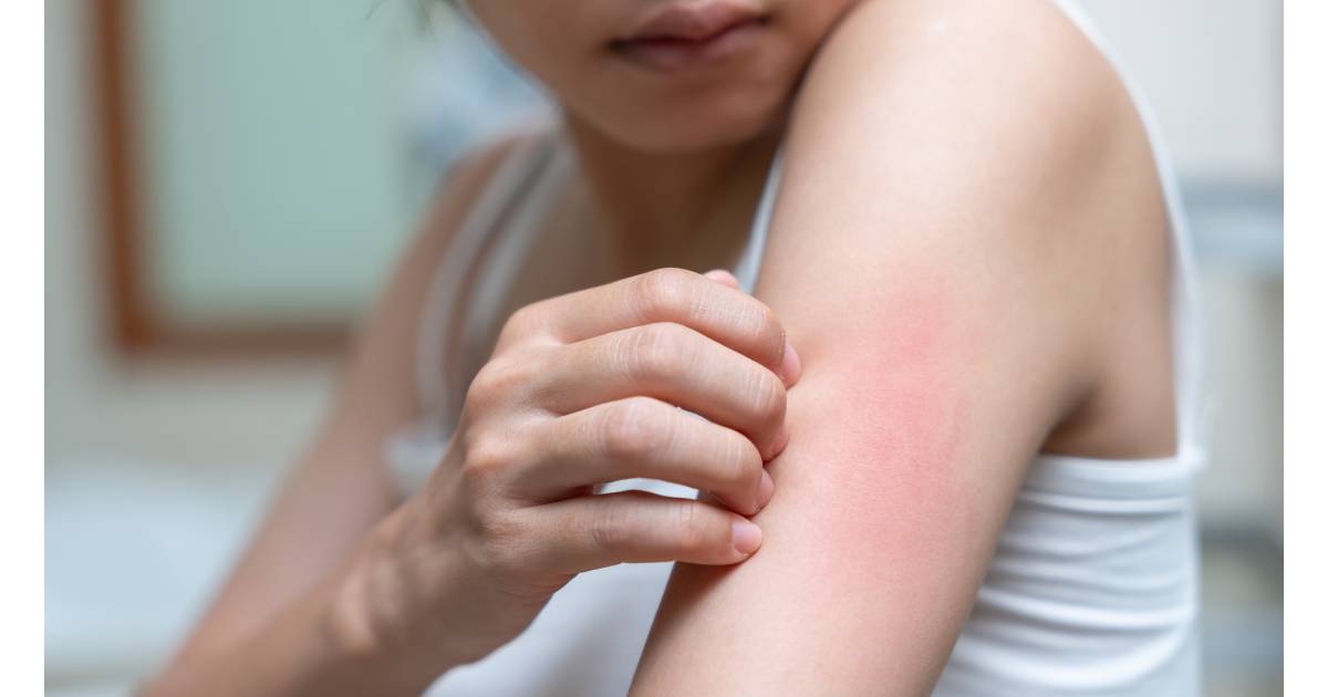 itchy skin from a parasitic infection