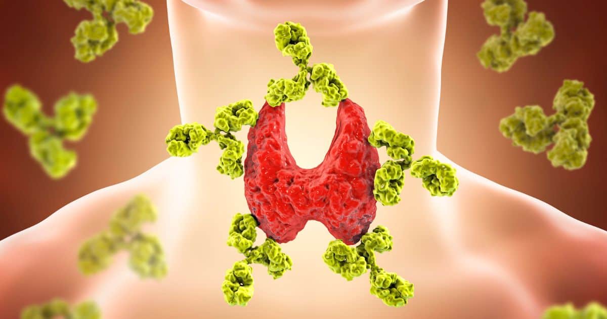effects on alcohol and thyroid autoimmunity